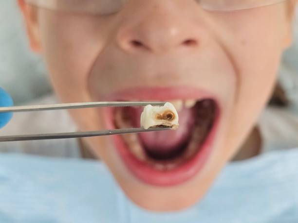 Best Emergency Treatment for Toothache in Indian River, MI