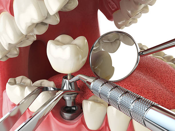 Best Emergency Treatment for Toothache in Indian River, MI